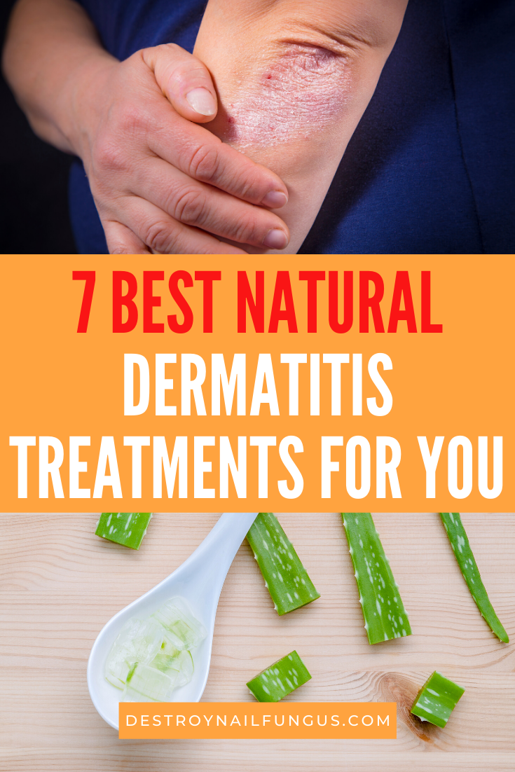 Dermatitis Remedies: Natural Treatments For Eczema Relief