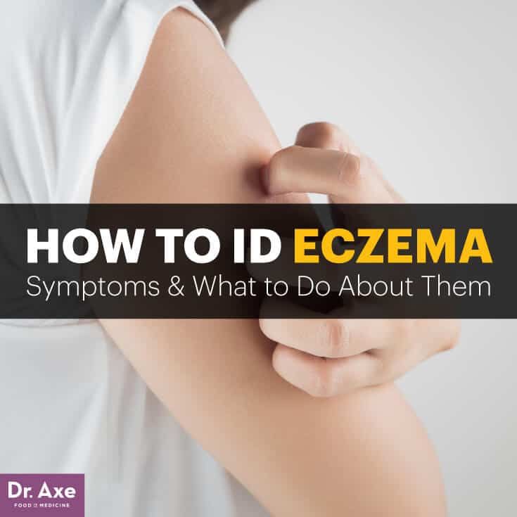 Dermatologists Often Fail to Treat These Root Causes of Eczema in 2020 ...