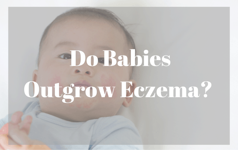 Did Your Baby Outgrow Eczema : What