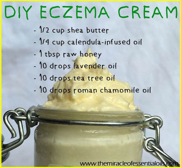 DIY Essential Oil Eczema Cream