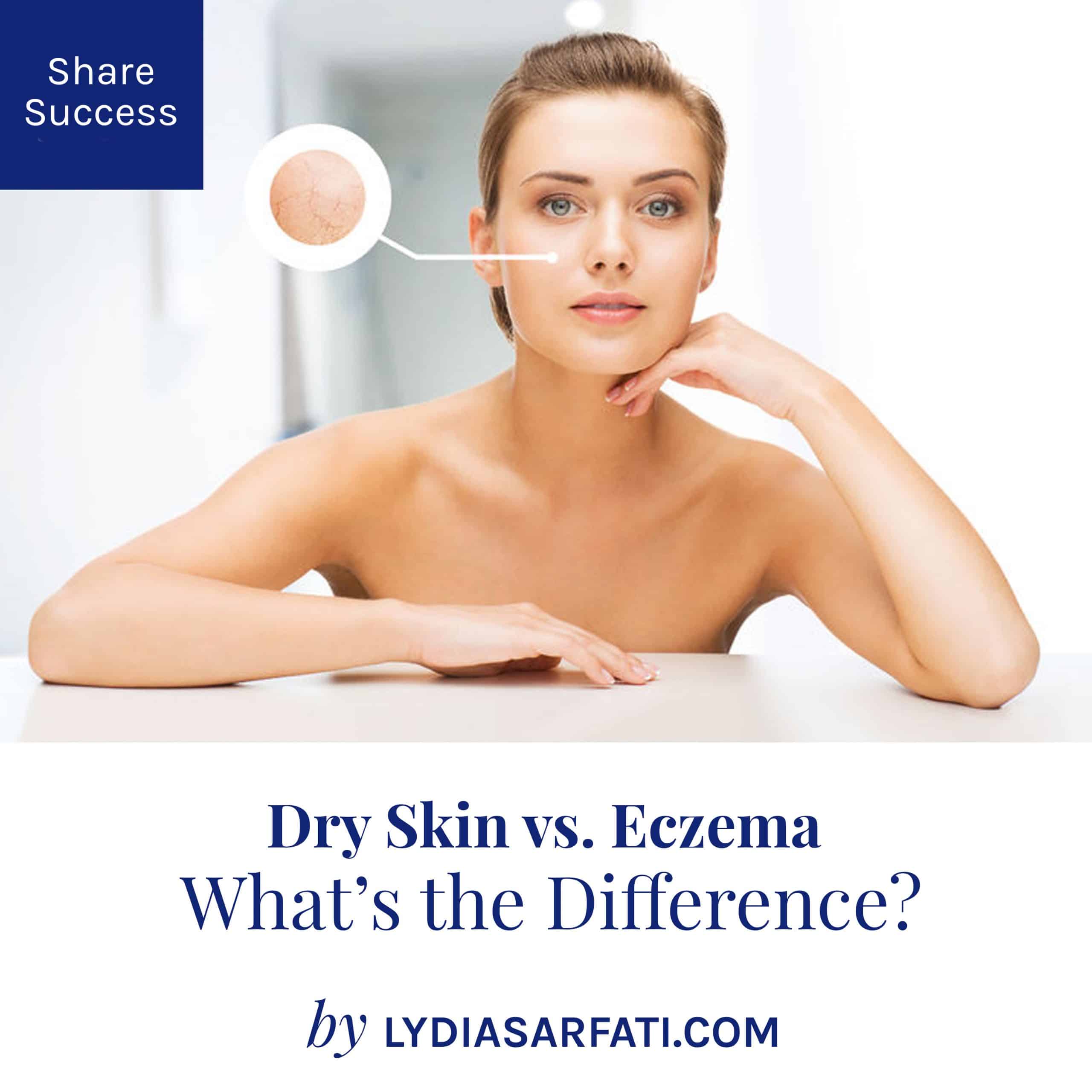 Dry Skin vs. Eczema: Whats the Difference and How to Address these ...