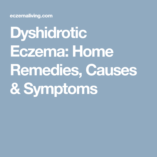 Dyshidrotic Eczema â Natural Home Remedies &  Treatment