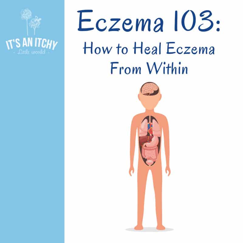Eczema 103: How to Heal Eczema From Within