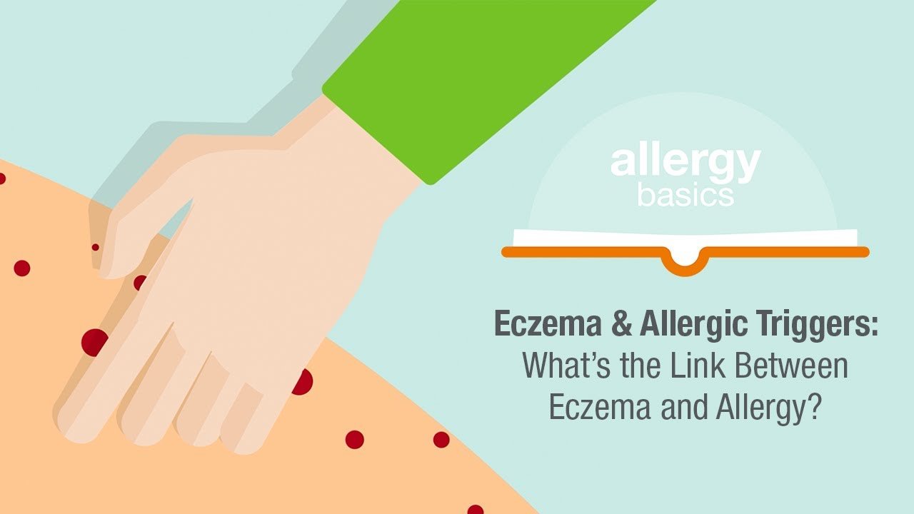 Eczema &  Allergic Triggers: What