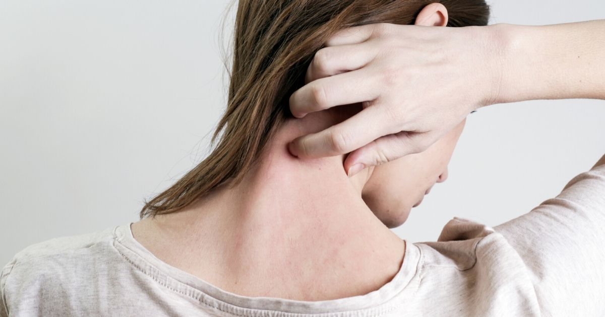 Eczema and Stress: the Connection Between Eczema and ...