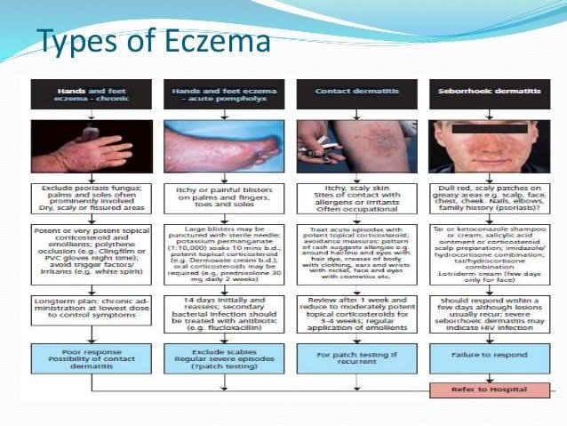 Eczema basic principles