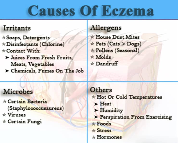 Eczema causes and triggers