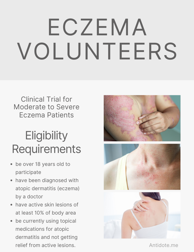 Eczema Clinical Trial