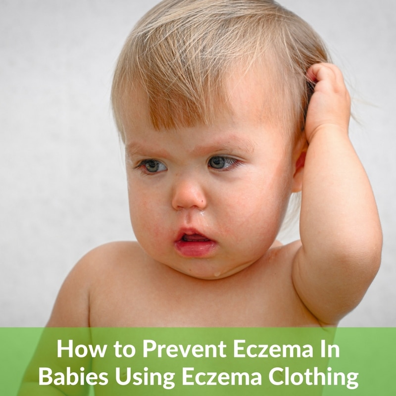 Eczema Clothing: How to Prevent Eczema in Your Children ...
