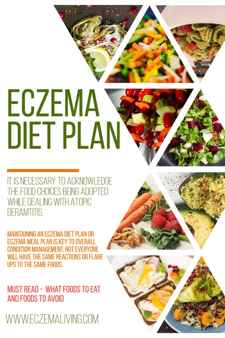 Eczema Diet: Foods to Eat and Foods to Avoid in 2020