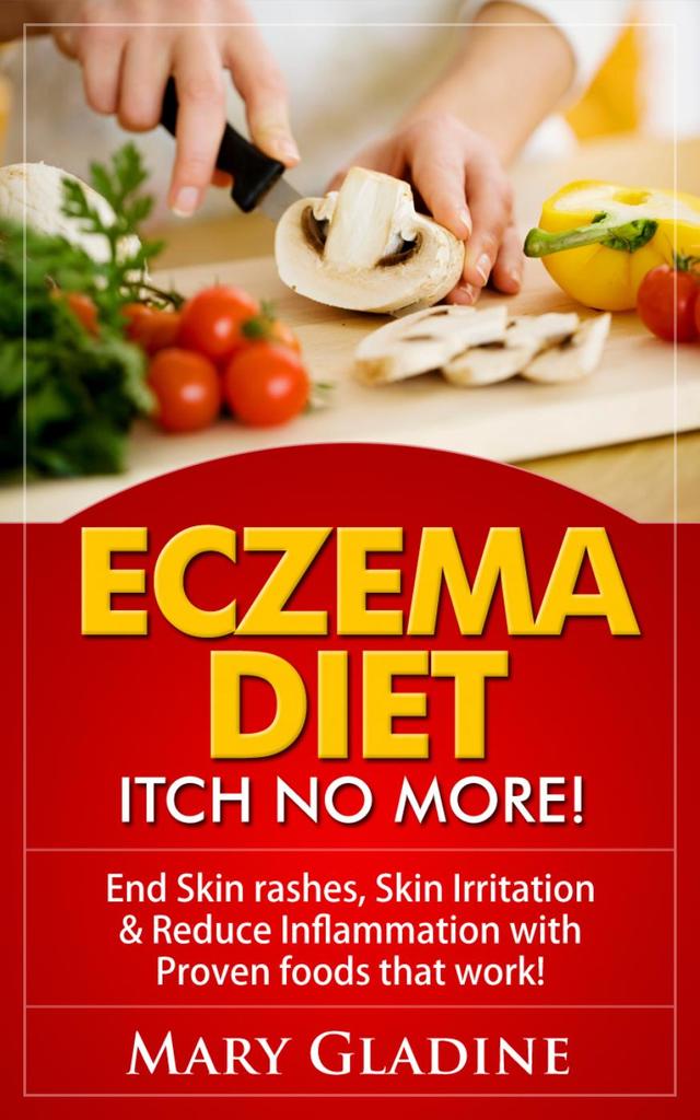 Eczema Diet: Itch No More! End Skin rashes, Skin Irritation &  Reduce ...