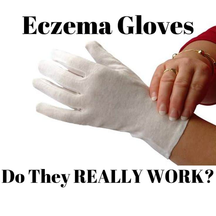 Eczema Gloves To Stop Scratching
