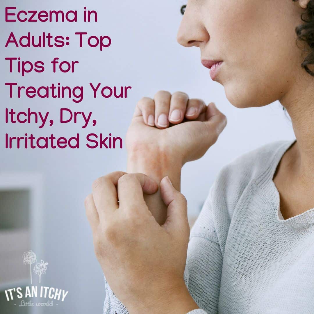 Eczema in Adults: Top Tips for Treating Your Itchy, Dry, Irritated Skin ...