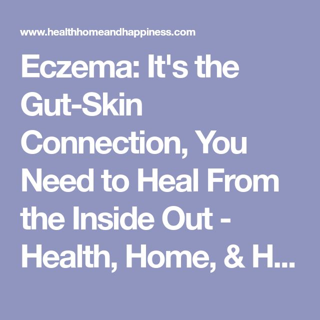 Eczema: It