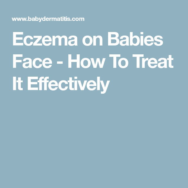 Eczema on Babies Face