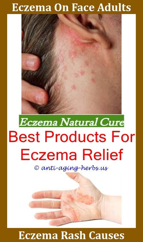 Eczema On Eyelid Montana Emu Oil For Eczema,eczema ...
