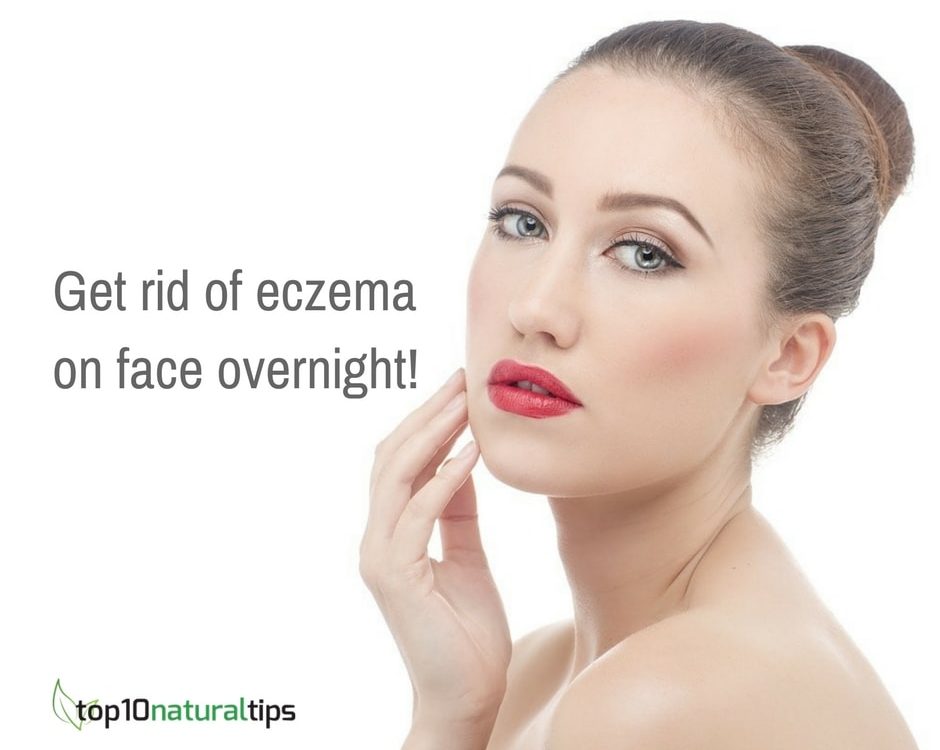 eczema on face cure