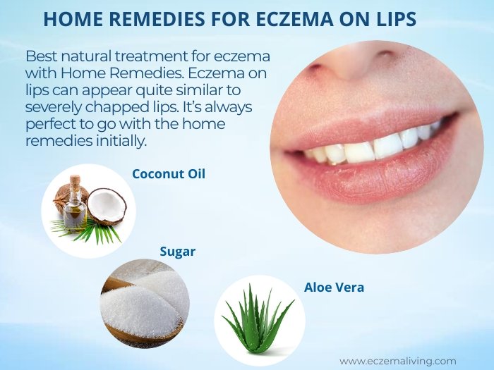 Eczema on Lips