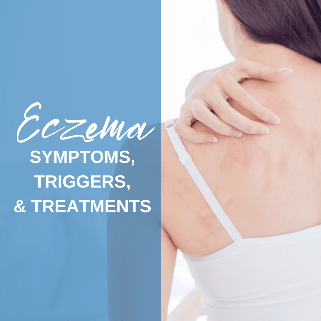 Eczema: Symptoms, Triggers, and Treatments