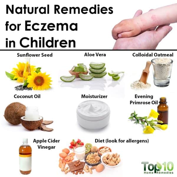 Eczema Treatment For Babies Home Remedies