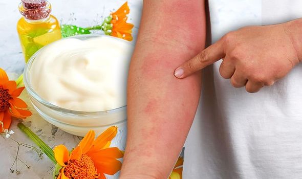 Eczema treatment: Prevent dry and itchy skin with a ...