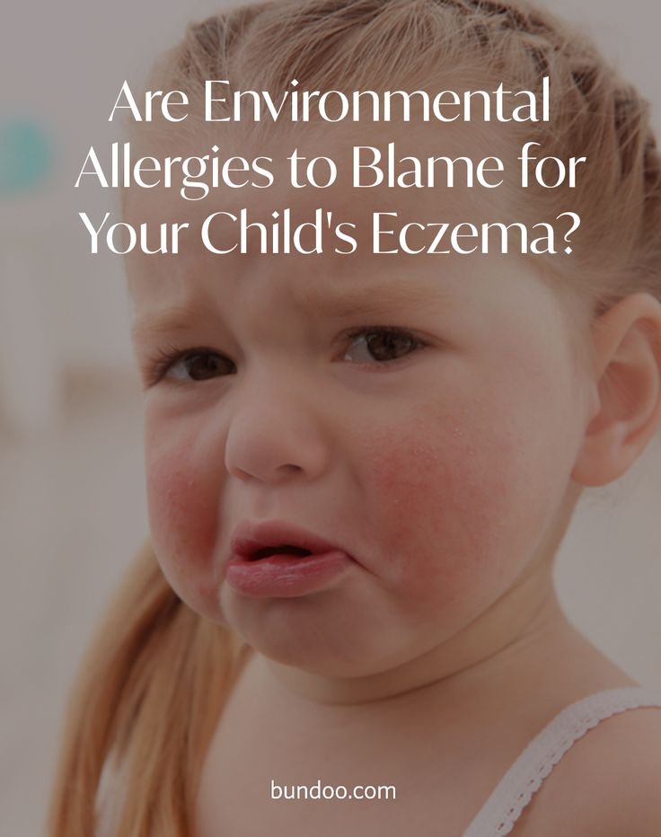 Environmental allergies and eczema in 2020