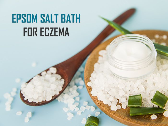Epsom Salt Bath for Eczema  Is It Good? How To Use It? in ...