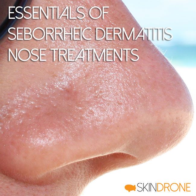 Essentials of Seborrheic Dermatitis Nose Treatments Cover ...