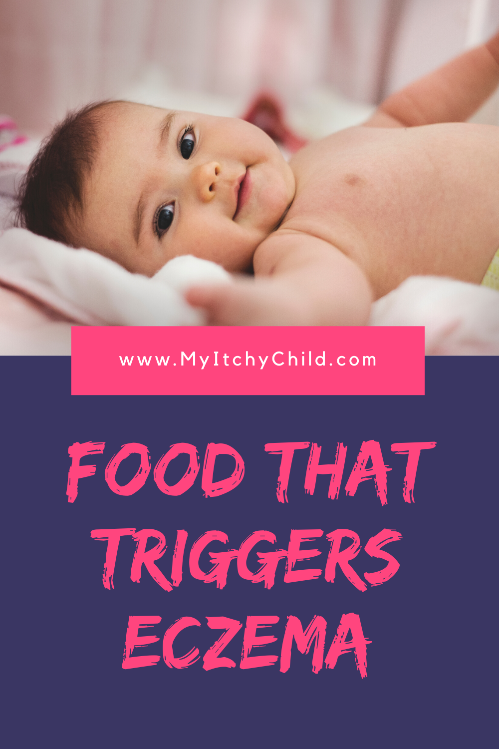 Food That Triggers Eczema