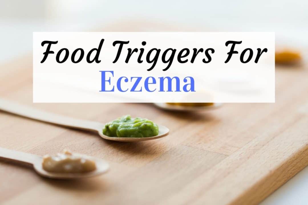 Foods To Avoid With Eczema In Toddlers