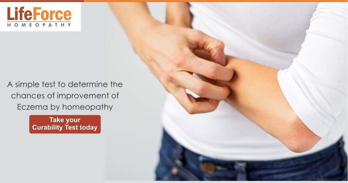 Get assured results with our Eczema treatment. Homeopathy ...