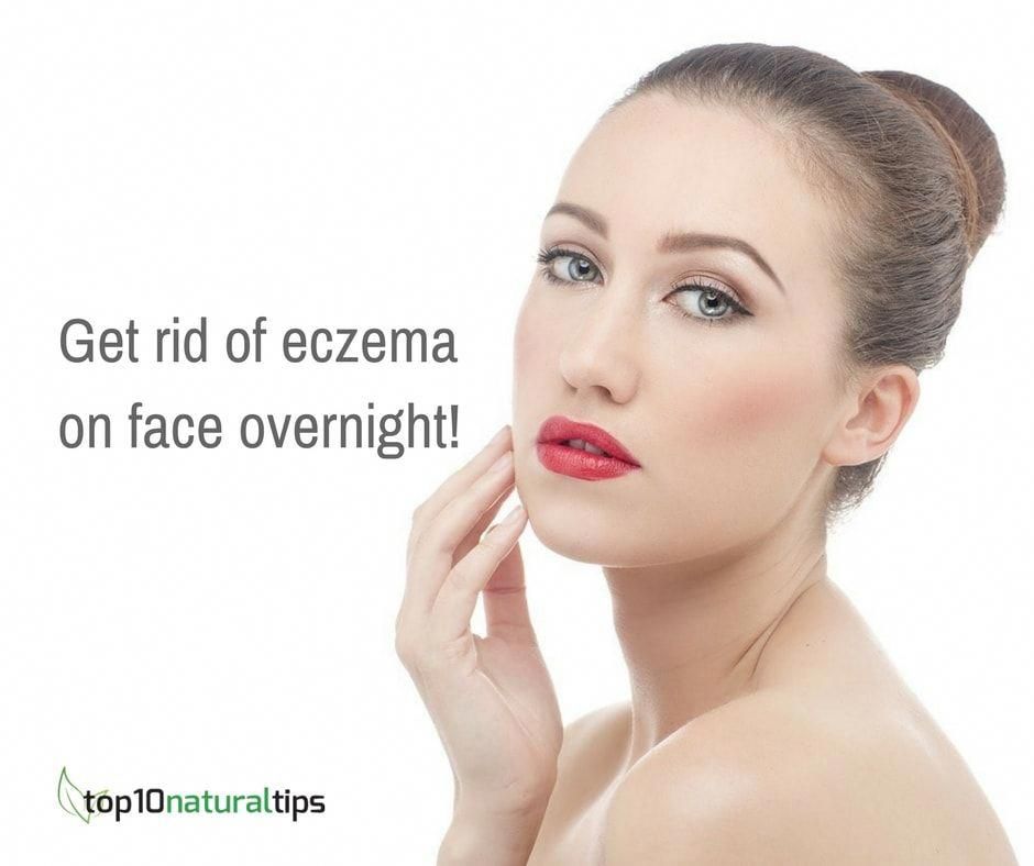 Get rid of eczema on face overnight naturally #getridofeczema