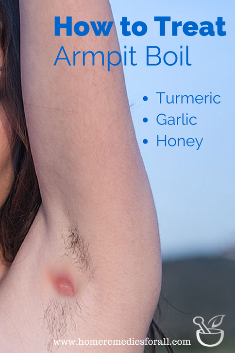 Get Rid of The Boil Under Armpit and Relieve Yourself from ...