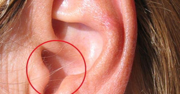 Having Hair in Your Ear Is A Warning Sign!