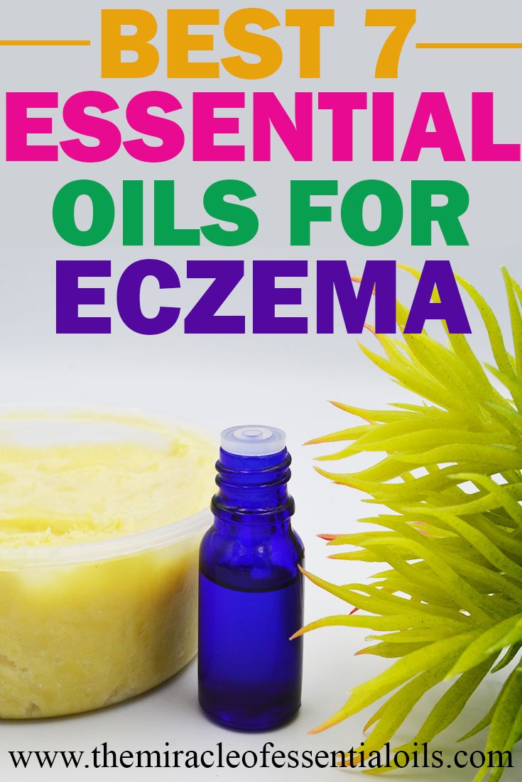 Healing with 7 Essential Oils for Severe Eczema + 3 Treatment Recipes ...