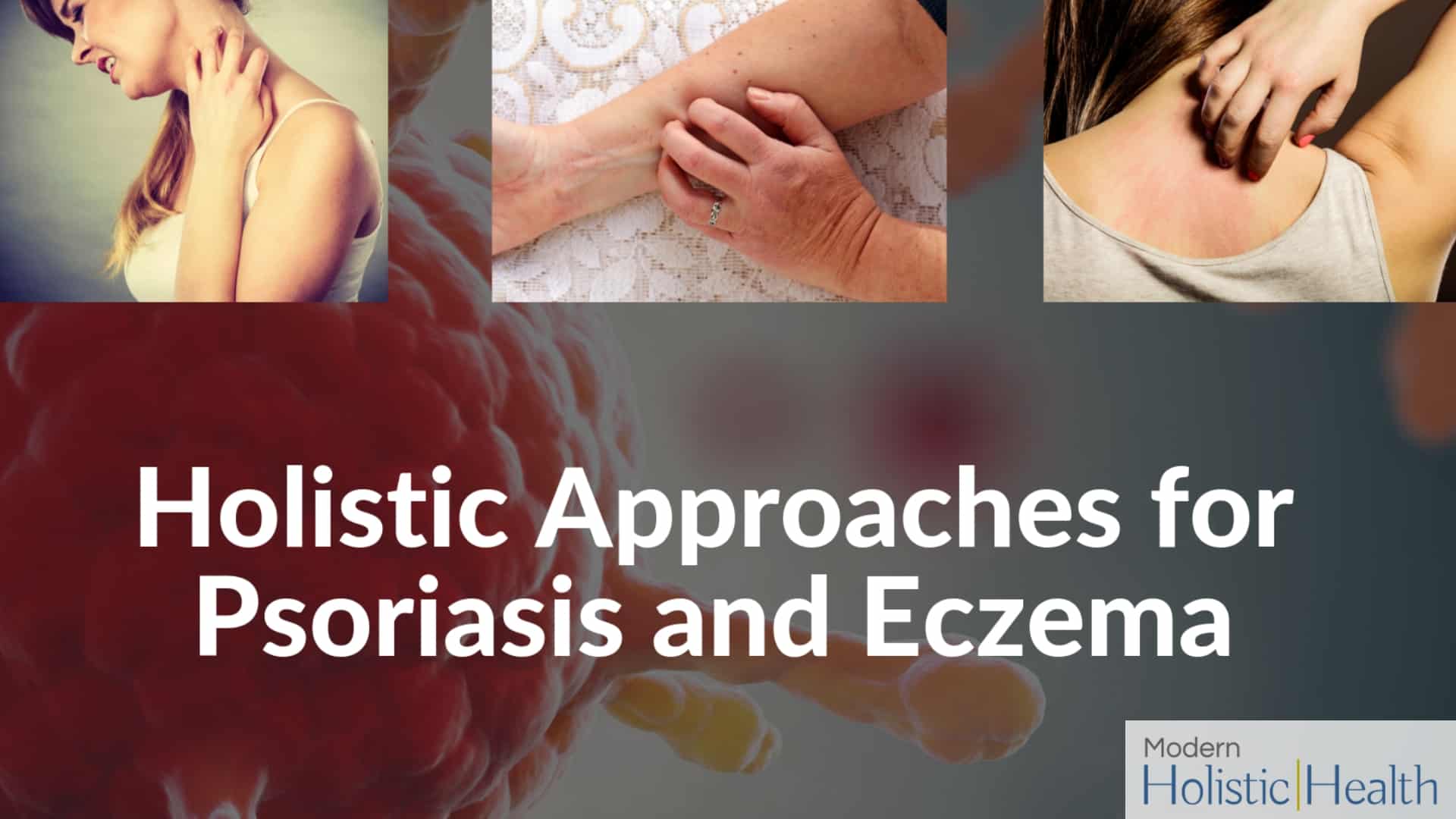 Holistic Approaches for Psoriasis and Eczema