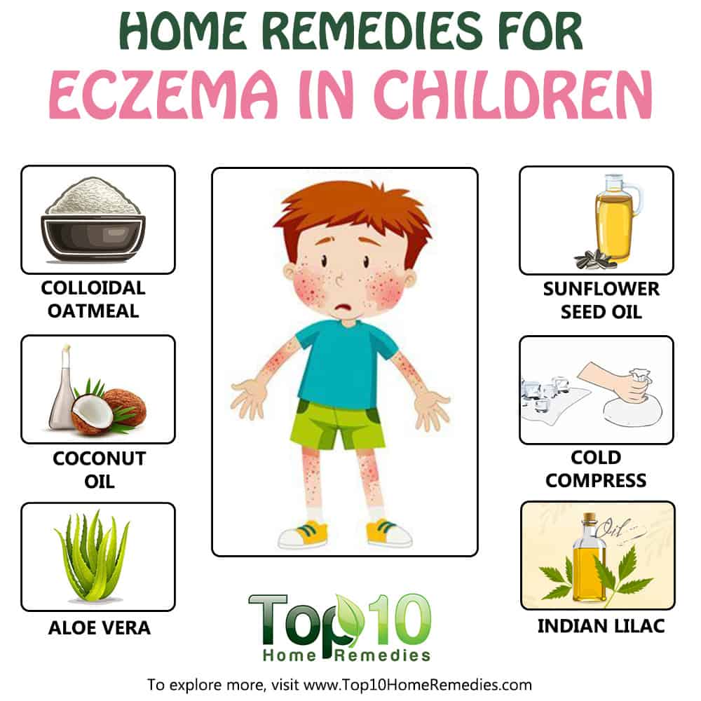 Home Remedies for Eczema in Children