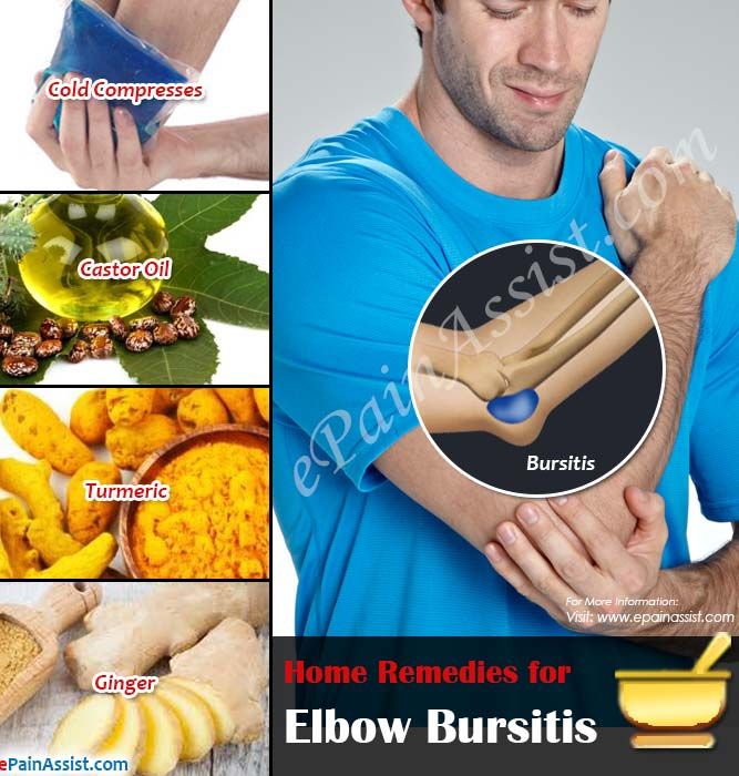 Home Remedies for Elbow Bursitis