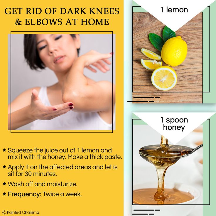 Home remedies to get rid of Dark Knees &  Elbows