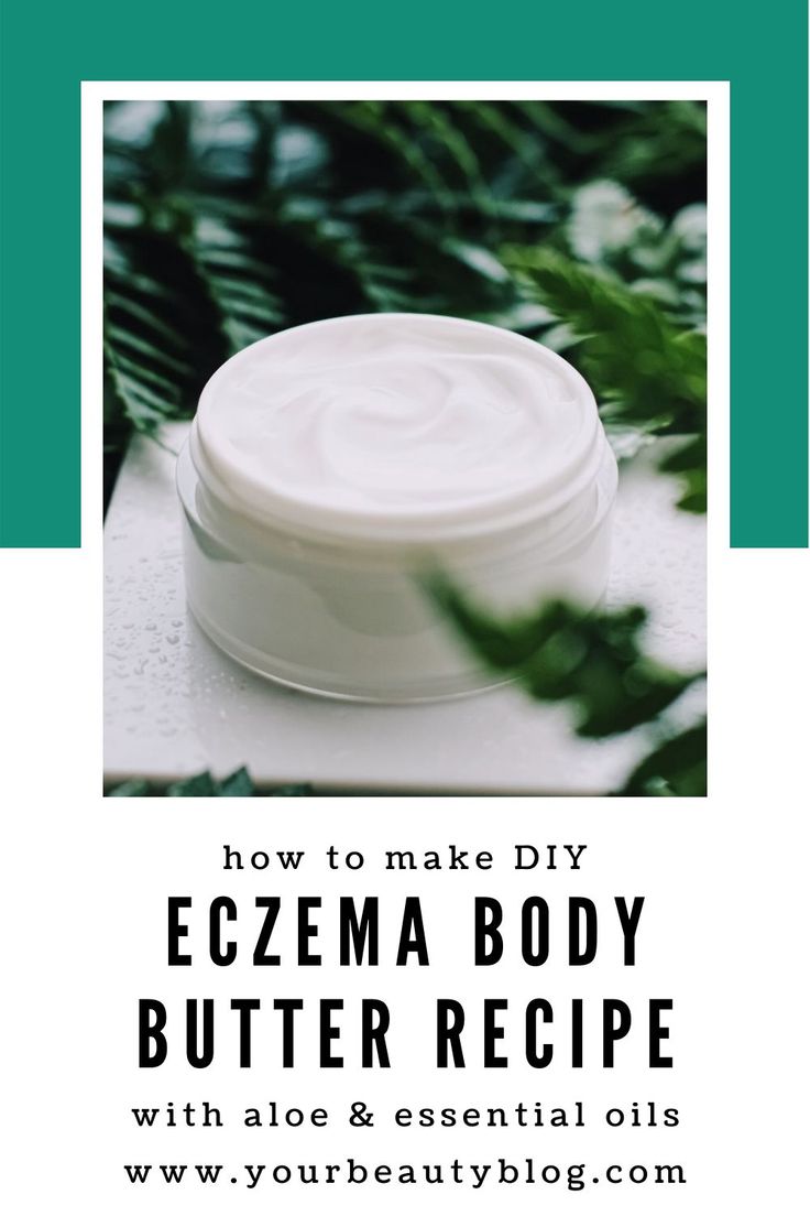 Homemade Eczema Body Butter Recipe Aloe Essential Oils ...