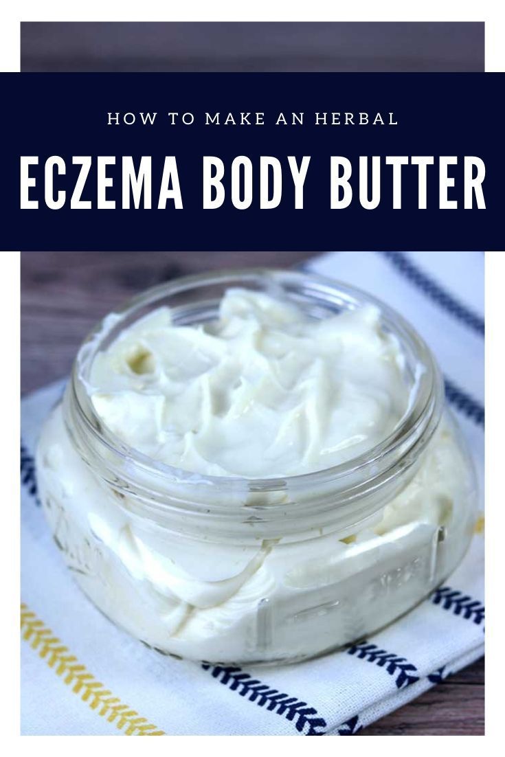 Homemade Eczema Body Butter With Aloe Vera