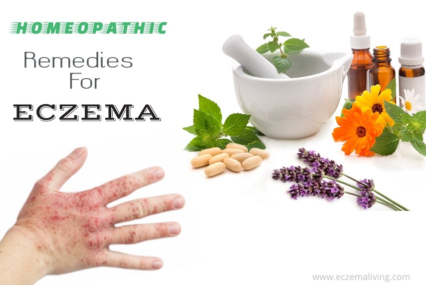 Homeopathy For Eczema