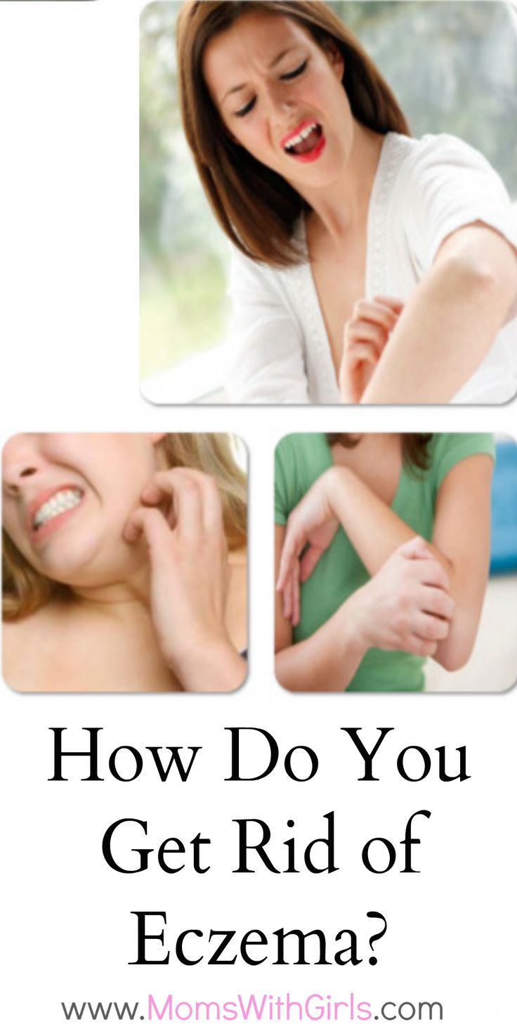 How do you get rid of eczema? #getridofwrinklescream