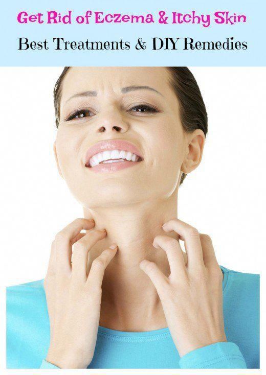 How do you get rid of eczema? With effective skin care ...