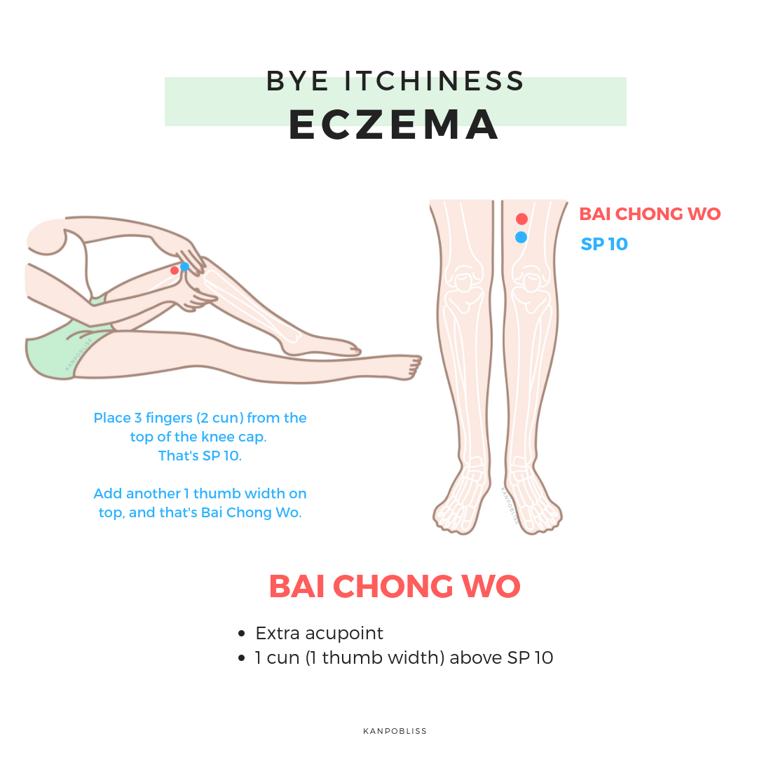 How does Chinese Medicine view Eczema