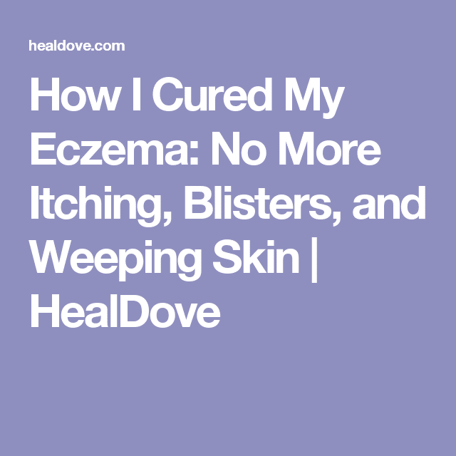 How I Cured My Eczema: No More Itching, Blisters, and Weeping Skin ...