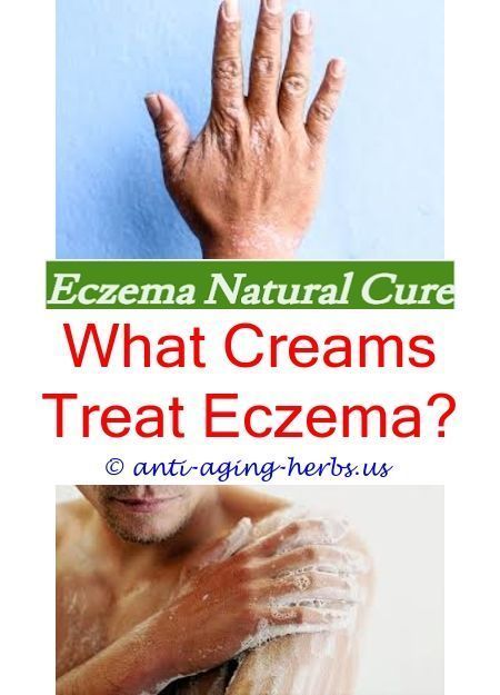 How to clear up eczema on hands.What foods not to eat if ...