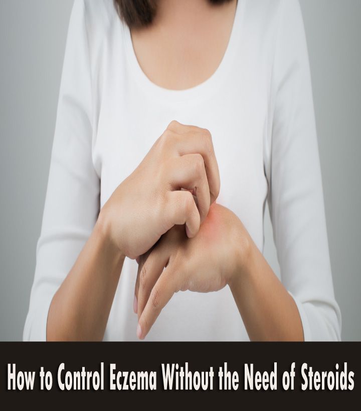 How to Control Eczema without the need of Steroids ...