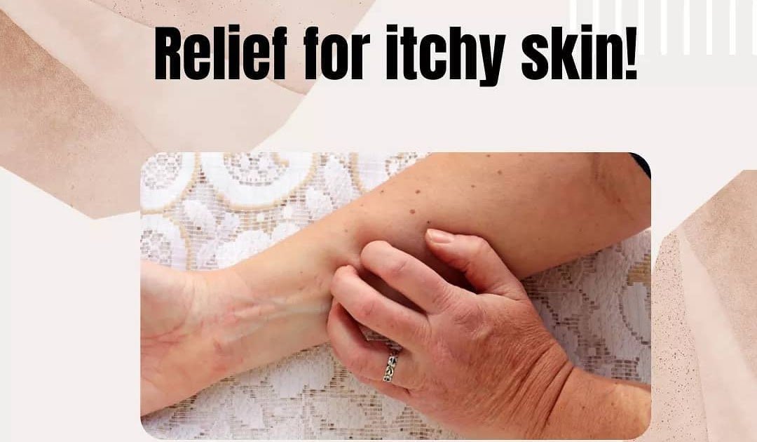 How To Cure Eczema Permanently: How to Stop Itching Completely With the ...