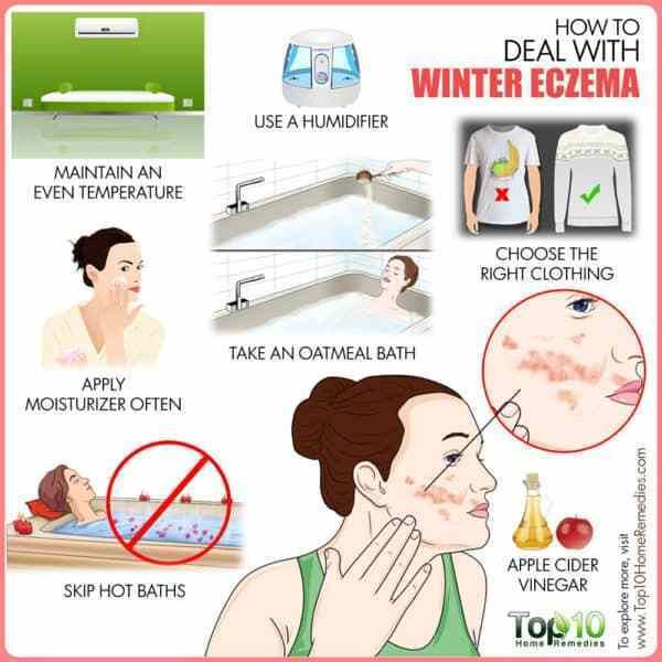 How to Deal with Winter Eczema